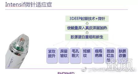 https://img.miyanlife.com/mnt/timg/180815/12444Q3Q-11.jpg