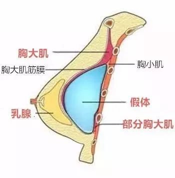 案例图片