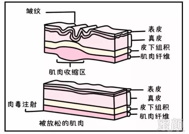https://img.miyanlife.com/mnt/timg/180816/1206302I9-1.jpg