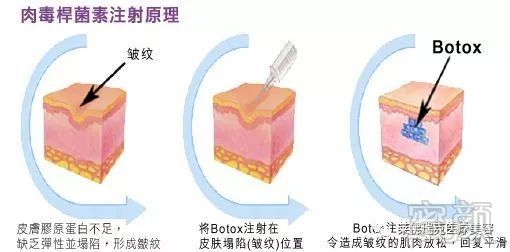 案例图片