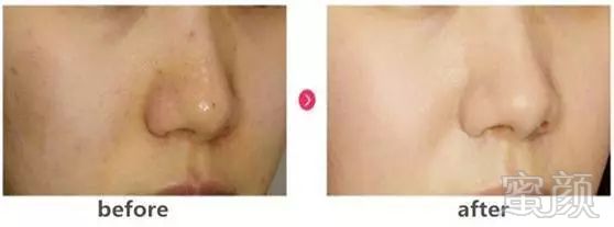 https://img.miyanlife.com/mnt/timg/180817/11300I101-5.jpg