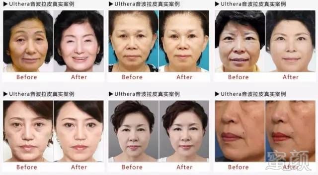 https://img.miyanlife.com/mnt/timg/180817/113250HZ-6.jpg