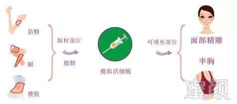 https://img.miyanlife.com/mnt/timg/180817/114220E23-1.jpg