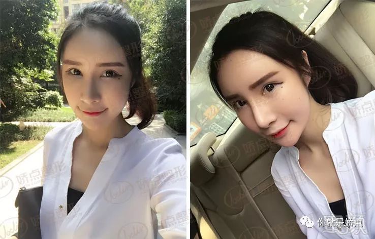 https://img.miyanlife.com/mnt/timg/180817/1142243643-3.jpg