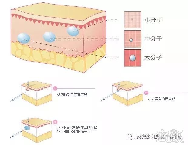 https://img.miyanlife.com/mnt/timg/180817/1323036057-1.jpg
