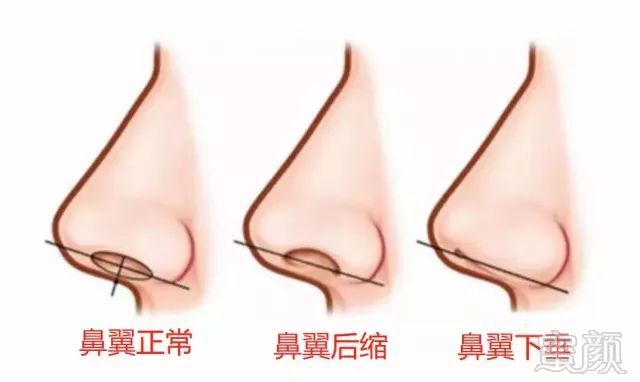 https://img.miyanlife.com/mnt/timg/180818/114U33330-6.jpg