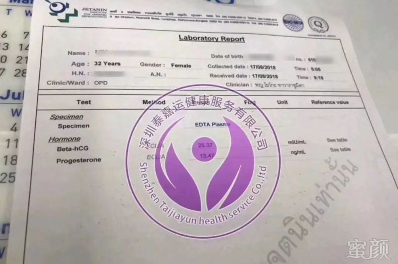 https://img.miyanlife.com/mnt/timg/180818/11514Q131-7.jpg