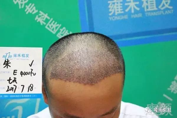 https://img.miyanlife.com/mnt/timg/180818/115Ha957-6.jpg