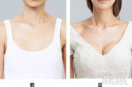https://img.miyanlife.com/mnt/timg/180818/115S25M6-1.jpg