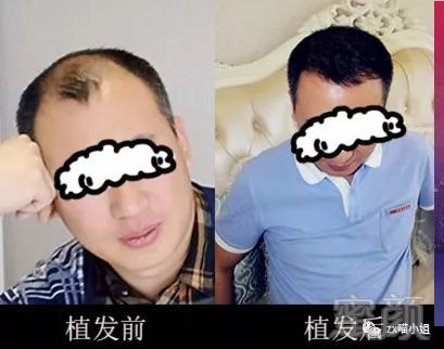 https://img.miyanlife.com/mnt/timg/180818/12000931J-4.jpg