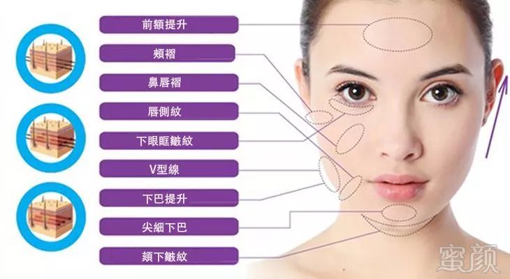 https://img.miyanlife.com/mnt/timg/180818/122144M41-10.jpg