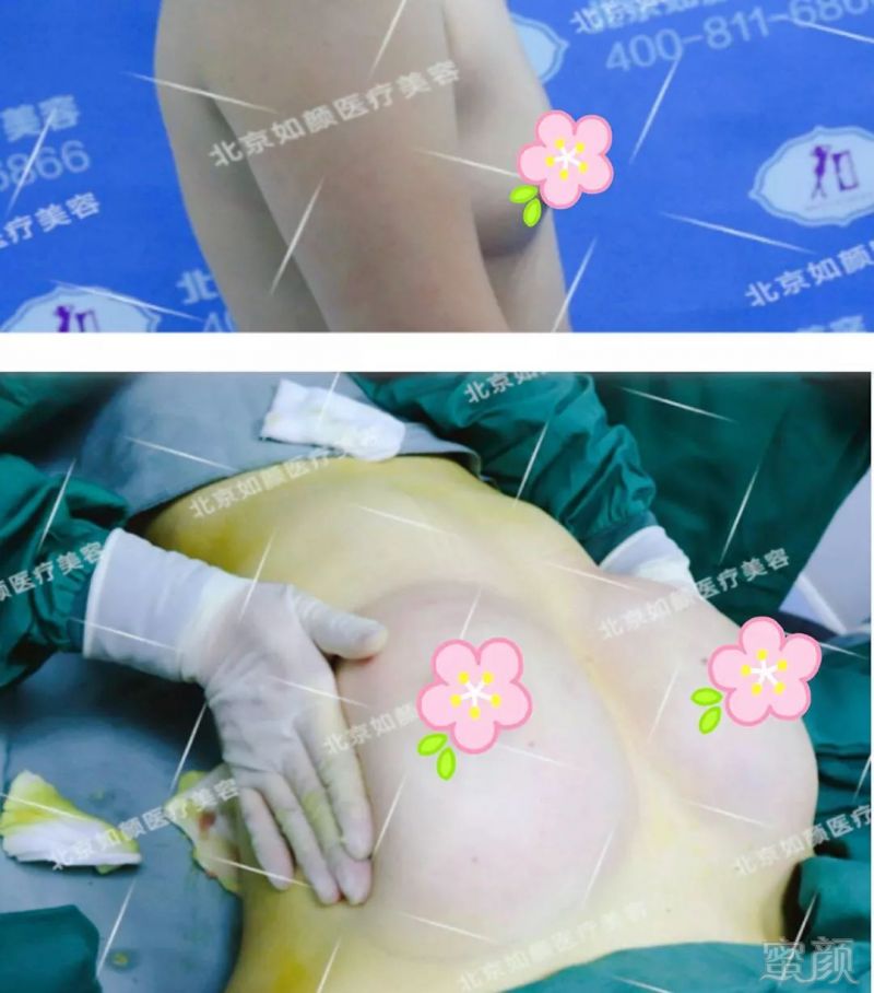 https://img.miyanlife.com/mnt/timg/180818/13021530L-5.jpg