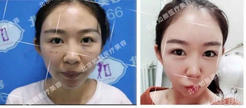 https://img.miyanlife.com/mnt/timg/180818/1302156416-6.jpg
