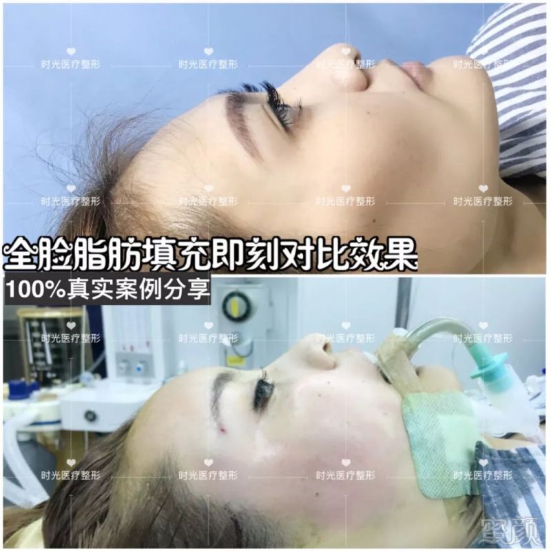 https://img.miyanlife.com/mnt/timg/180819/10021932G-11.jpg