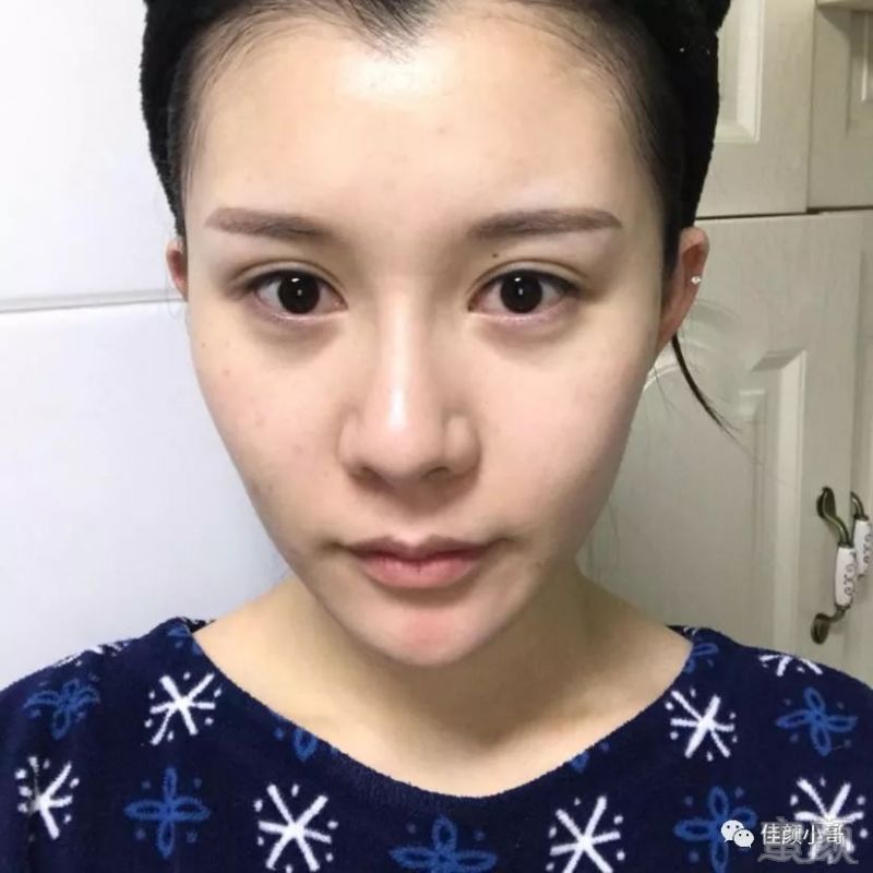 https://img.miyanlife.com/mnt/timg/180819/1003133L1-0.jpg