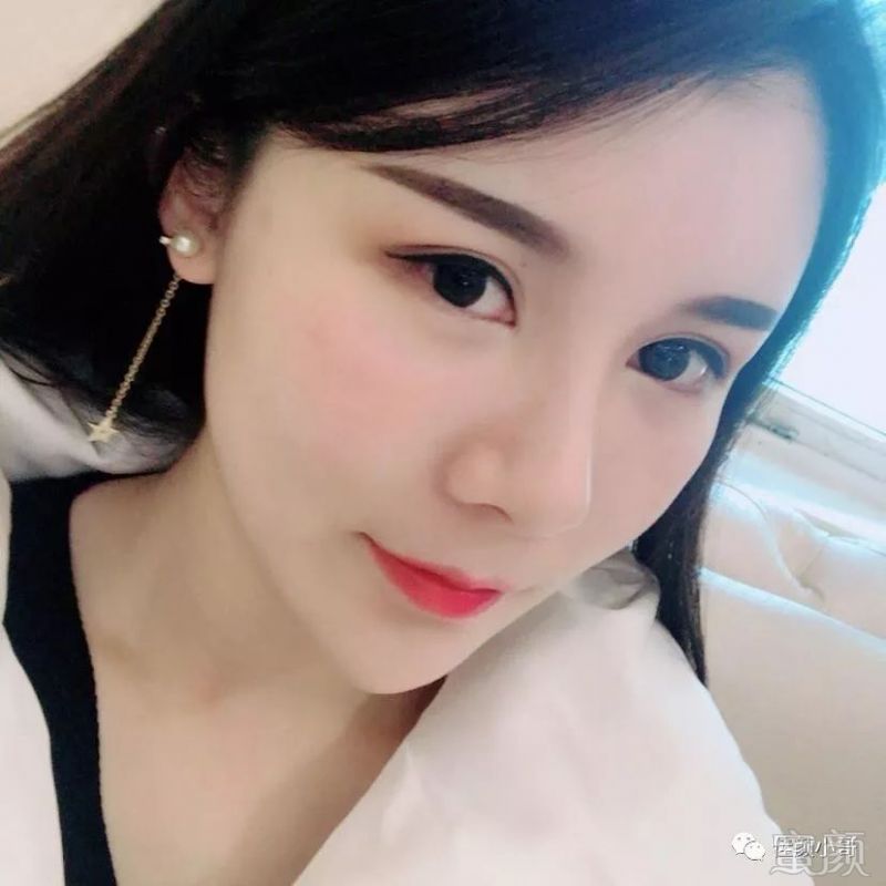 https://img.miyanlife.com/mnt/timg/180819/1003143R4-2.jpg