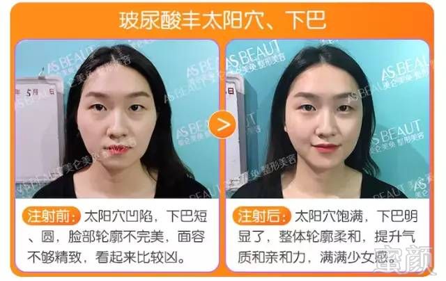 https://img.miyanlife.com/mnt/timg/180819/101242M52-3.jpg