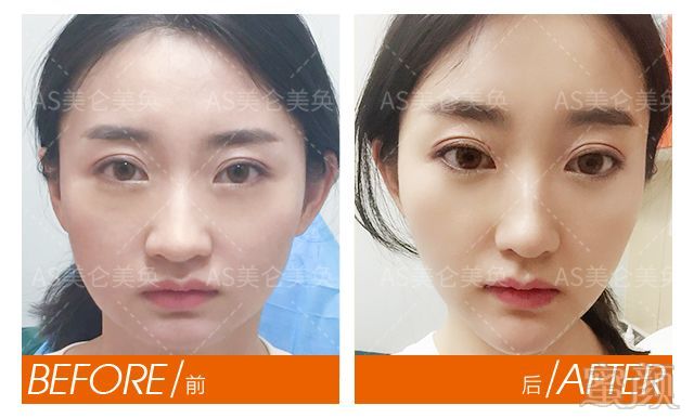 https://img.miyanlife.com/mnt/timg/180819/1012431437-6.jpg