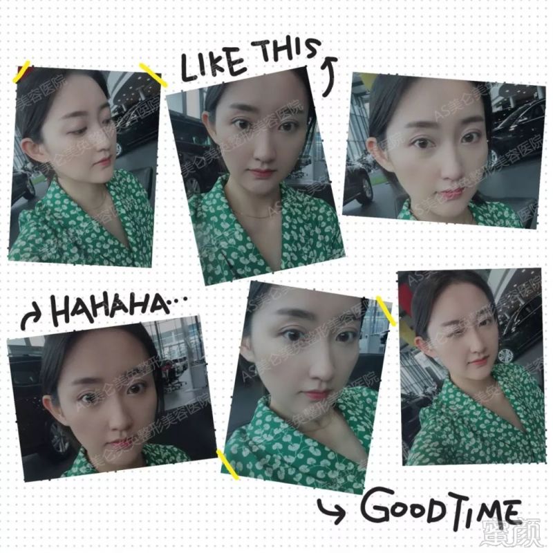 https://img.miyanlife.com/mnt/timg/180819/1012432330-7.jpg