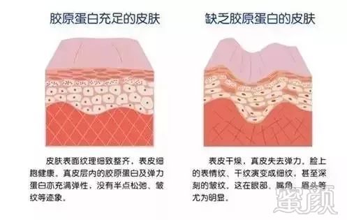 https://img.miyanlife.com/mnt/timg/180819/1023135438-0.jpg