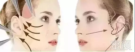 https://img.miyanlife.com/mnt/timg/180819/1023161096-4.jpg