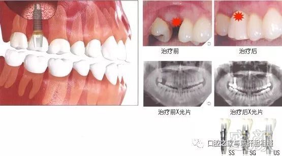 https://img.miyanlife.com/mnt/timg/180819/10350955K-0.jpg