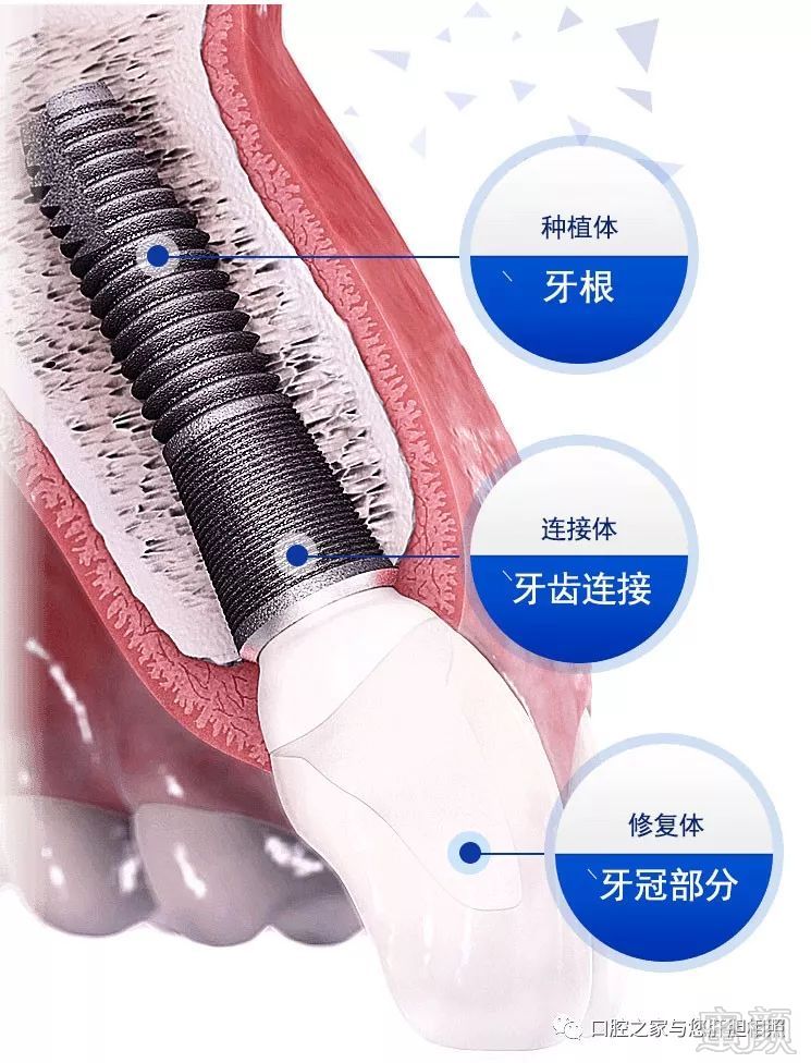 https://img.miyanlife.com/mnt/timg/180819/1035103422-2.jpg