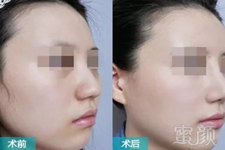 https://img.miyanlife.com/mnt/timg/180819/110K14G3-4.jpg