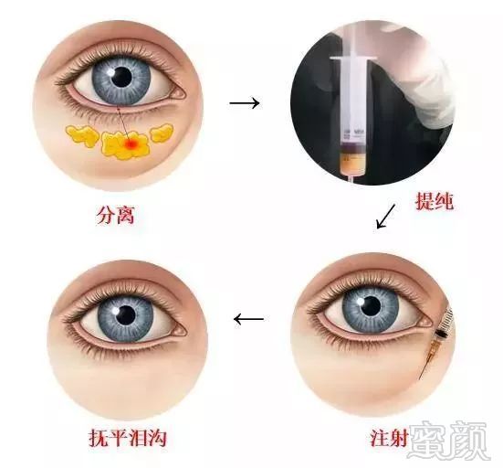 https://img.miyanlife.com/mnt/timg/180819/1122313441-9.jpg