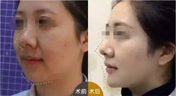 https://img.miyanlife.com/mnt/timg/180819/1201052545-4.jpg