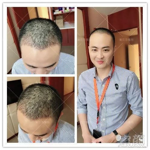 https://img.miyanlife.com/mnt/timg/180819/12052560a-9.jpg