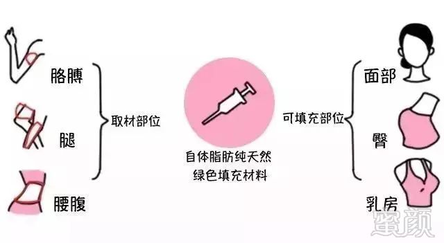 https://img.miyanlife.com/mnt/timg/180820/11594L043-4.jpg
