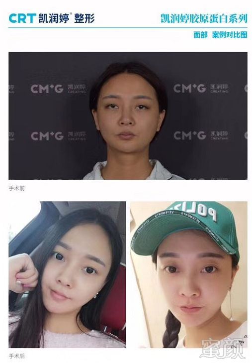 https://img.miyanlife.com/mnt/timg/180820/12125G506-3.jpg