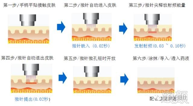 案例图片