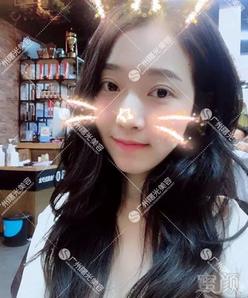 https://img.miyanlife.com/mnt/timg/180820/135A34G5-9.jpg