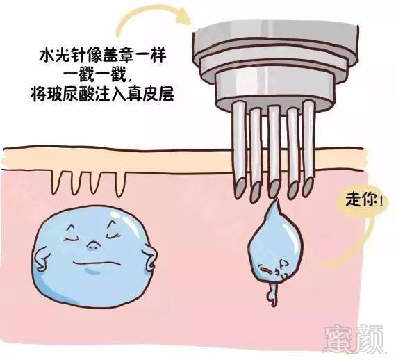 https://img.miyanlife.com/mnt/timg/180821/112A05940-3.jpg