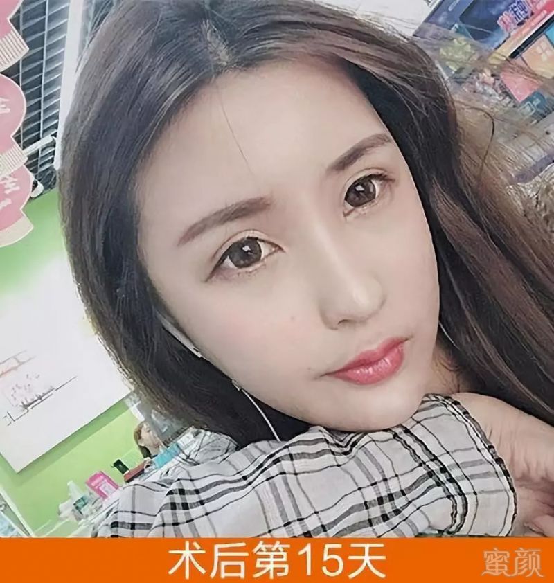 https://img.miyanlife.com/mnt/timg/180822/1120491A8-6.jpg
