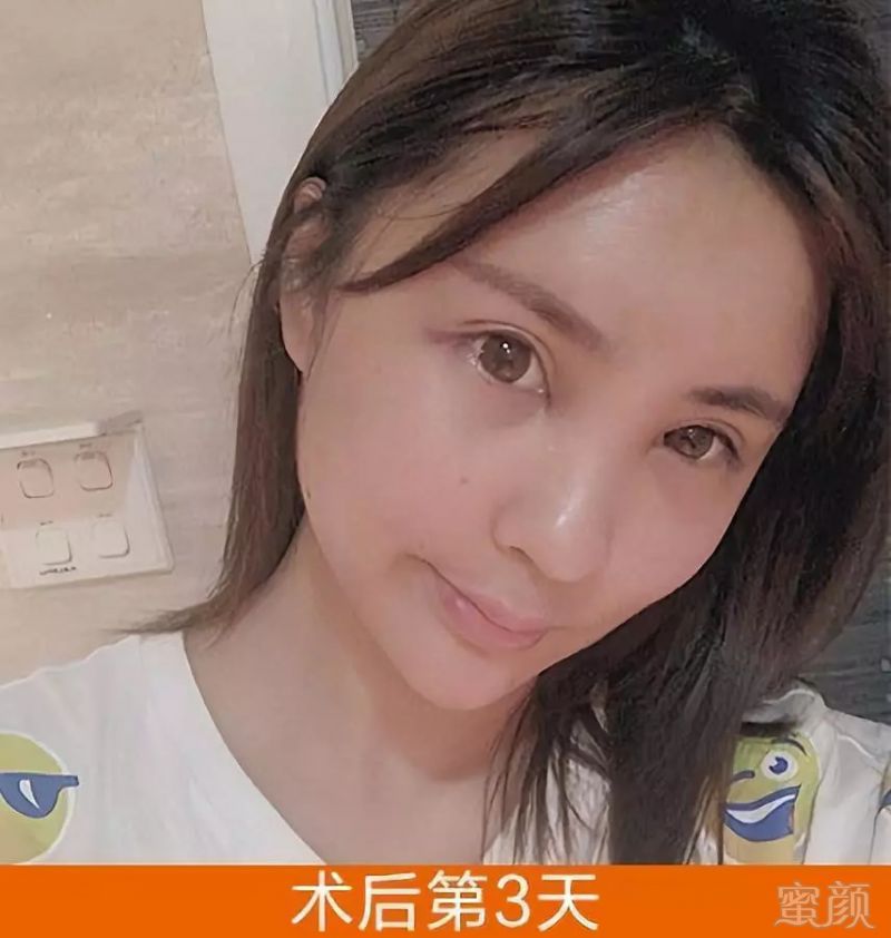 https://img.miyanlife.com/mnt/timg/180822/11204L127-5.jpg