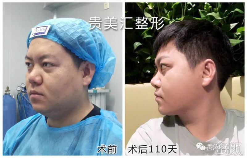 https://img.miyanlife.com/mnt/timg/180822/1130161508-6.jpg