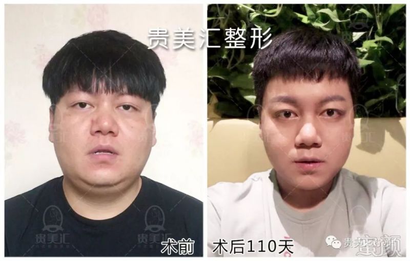 https://img.miyanlife.com/mnt/timg/180822/11301A141-5.jpg