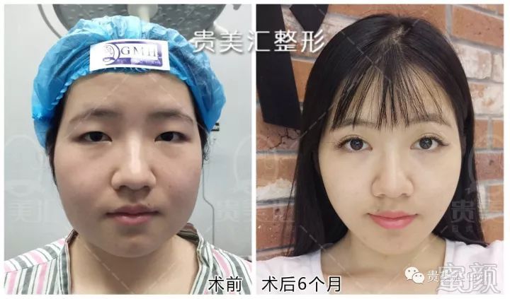 https://img.miyanlife.com/mnt/timg/180822/11301GM1-8.jpg