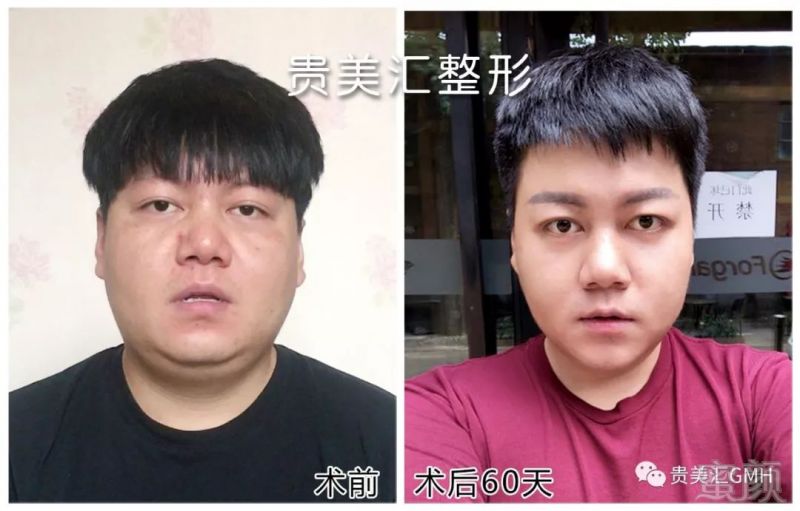 https://img.miyanlife.com/mnt/timg/180822/11301K518-7.jpg