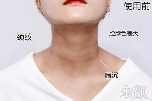 https://img.miyanlife.com/mnt/timg/180822/113935F53-3.jpg