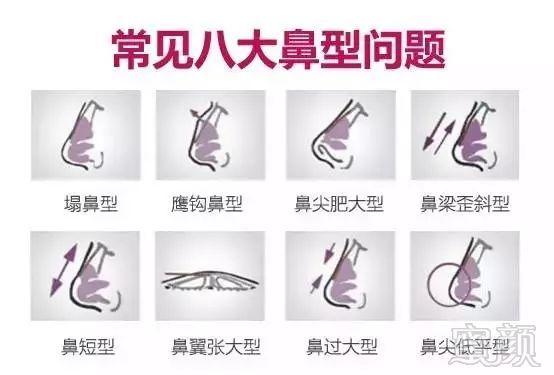 https://img.miyanlife.com/mnt/timg/180822/1143035U9-4.jpg