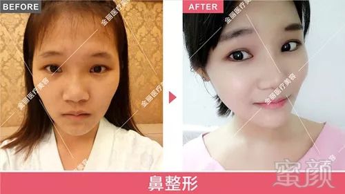 https://img.miyanlife.com/mnt/timg/180822/11430545Y-11.jpg