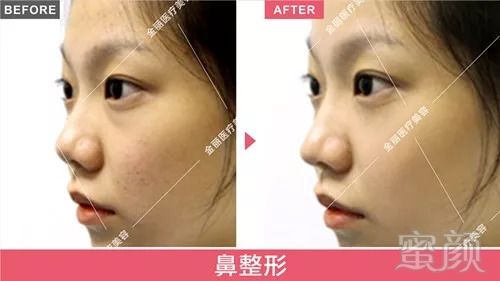https://img.miyanlife.com/mnt/timg/180822/11430554E-12.jpg