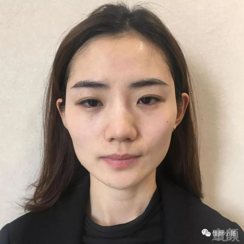 https://img.miyanlife.com/mnt/timg/180822/1143491335-0.jpg