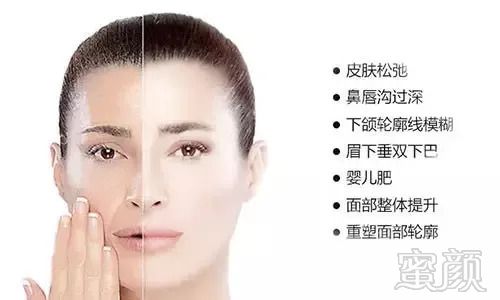 https://img.miyanlife.com/mnt/timg/180822/1150293238-4.jpg