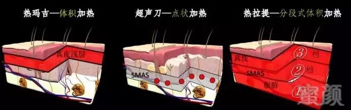 https://img.miyanlife.com/mnt/timg/180822/1150303227-5.jpg