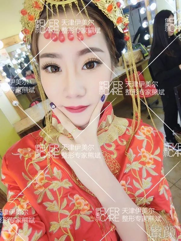 https://img.miyanlife.com/mnt/timg/180822/11554112D-5.jpg